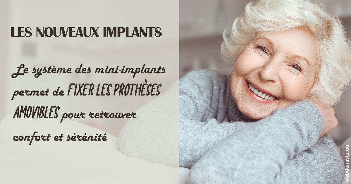 https://dr-pensa-sandra.chirurgiens-dentistes.fr/Les nouveaux implants 1