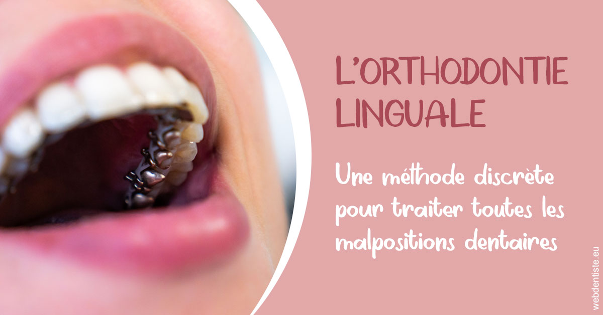 https://dr-pensa-sandra.chirurgiens-dentistes.fr/L'orthodontie linguale 2