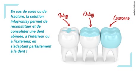 https://dr-pensa-sandra.chirurgiens-dentistes.fr/L'INLAY ou l'ONLAY