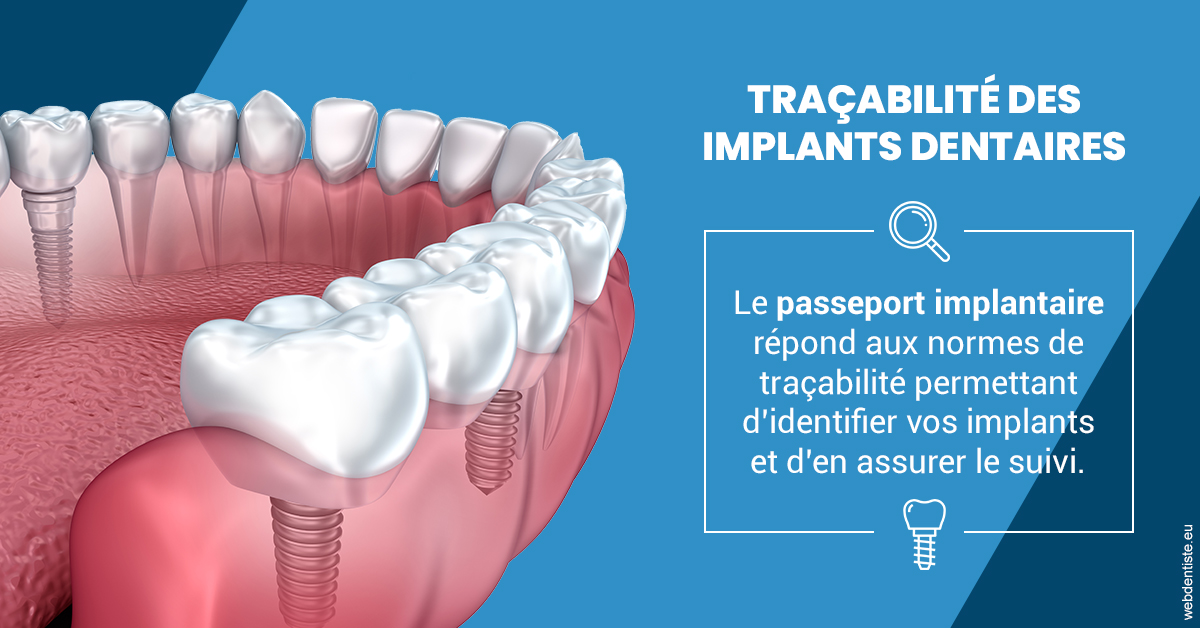 https://dr-pensa-sandra.chirurgiens-dentistes.fr/T2 2023 - Traçabilité des implants 1