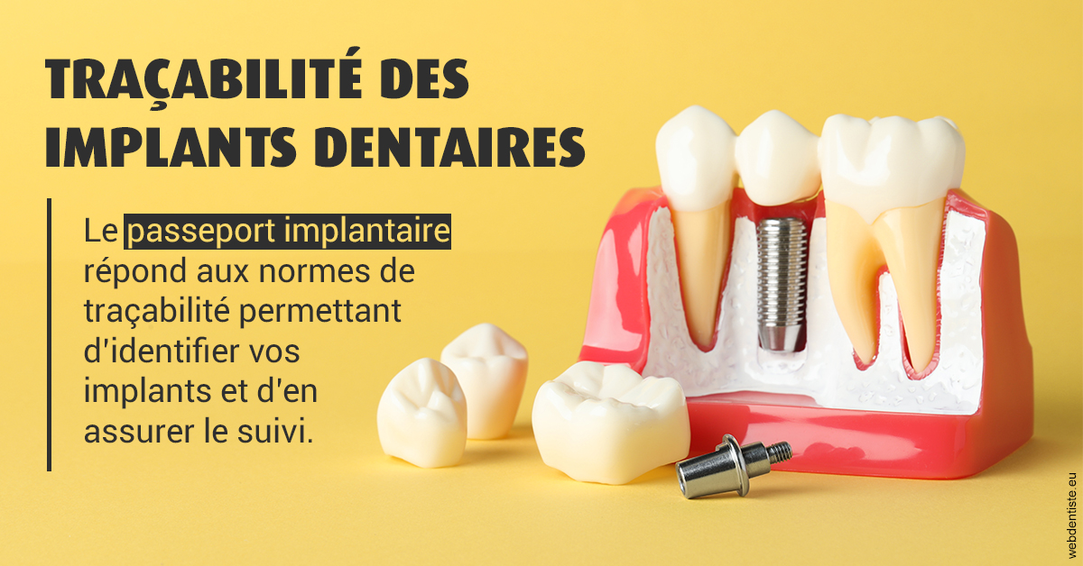 https://dr-pensa-sandra.chirurgiens-dentistes.fr/T2 2023 - Traçabilité des implants 2