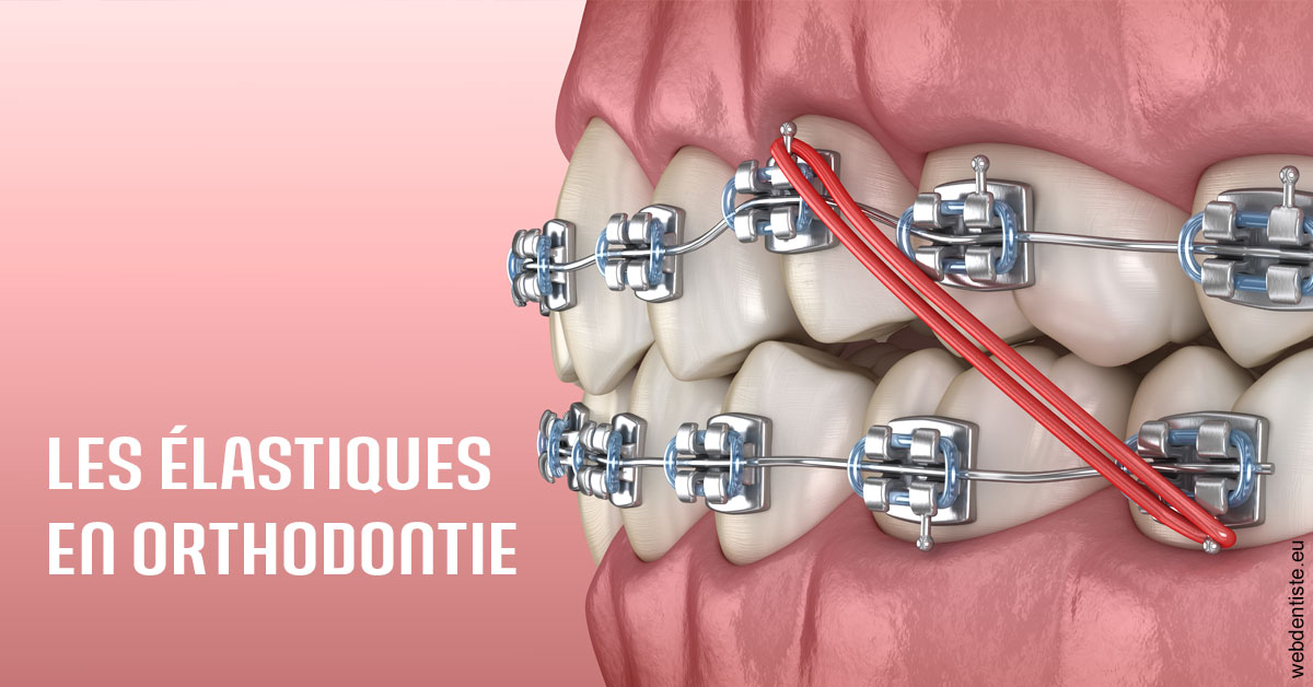 https://dr-pensa-sandra.chirurgiens-dentistes.fr/Elastiques orthodontie 2