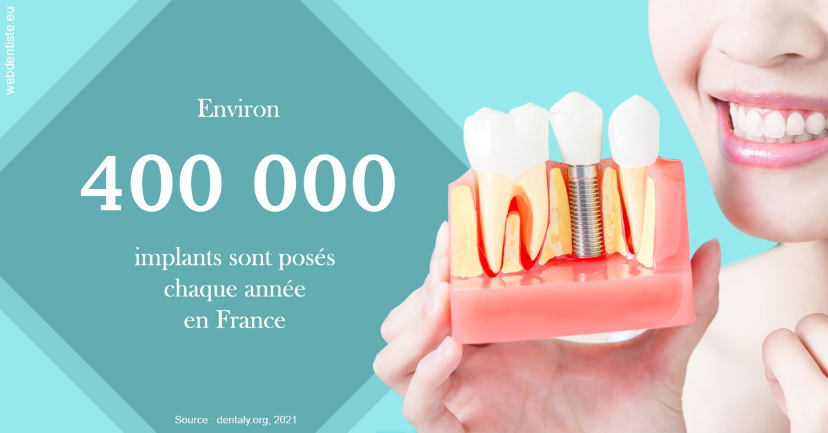 https://dr-pensa-sandra.chirurgiens-dentistes.fr/Pose d'implants en France 2