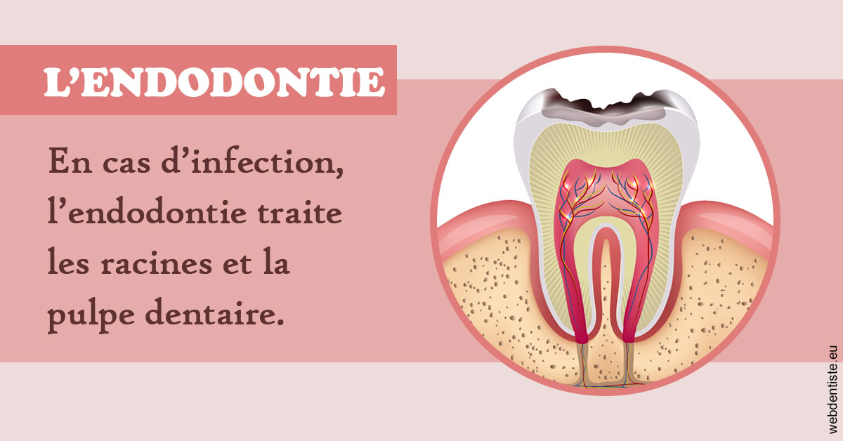 https://dr-pensa-sandra.chirurgiens-dentistes.fr/L'endodontie 2